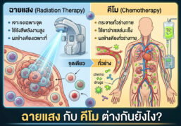ฉายแสง กับ คีโม ต่างกันยังไง? พร้อมเปิดเคล็ดลับบำรุงเม็ดเลือดขาวให้คนทำคีโมผ่านฉลุย!